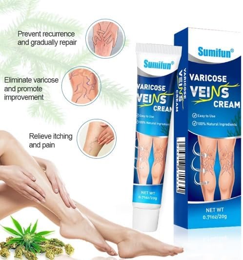 Varicose Veins Relief Cream