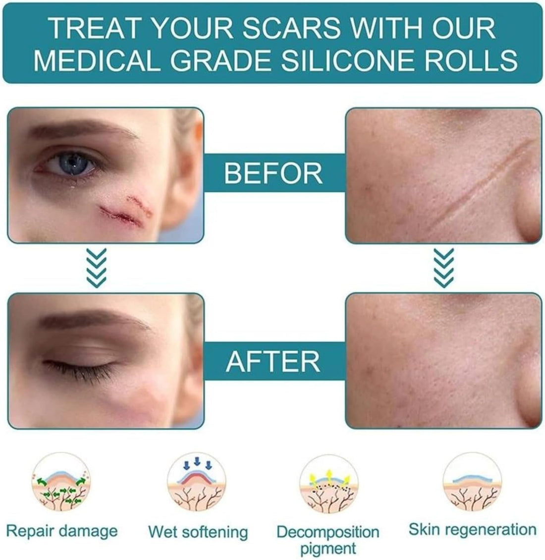 Silicone Scar Removal Sheets (2 Pack)